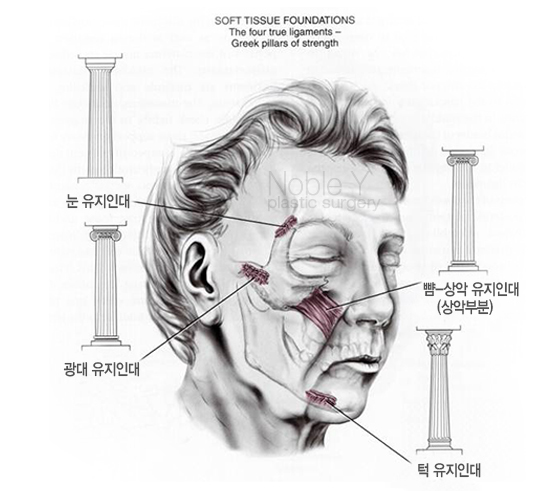 이마눈썹거상술