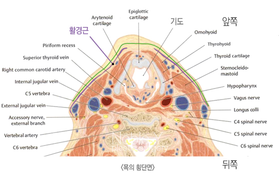 목주름