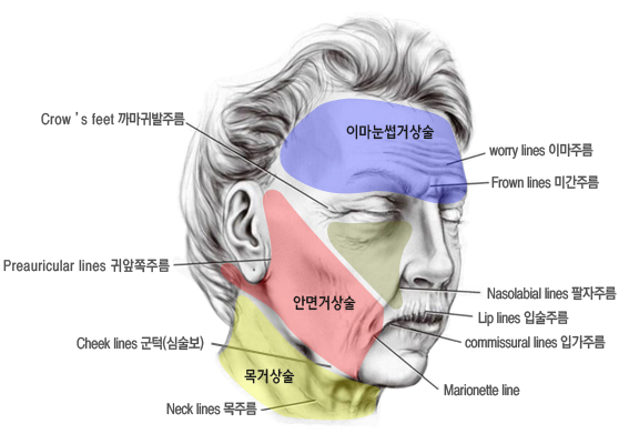 볼처짐(안면거상술)