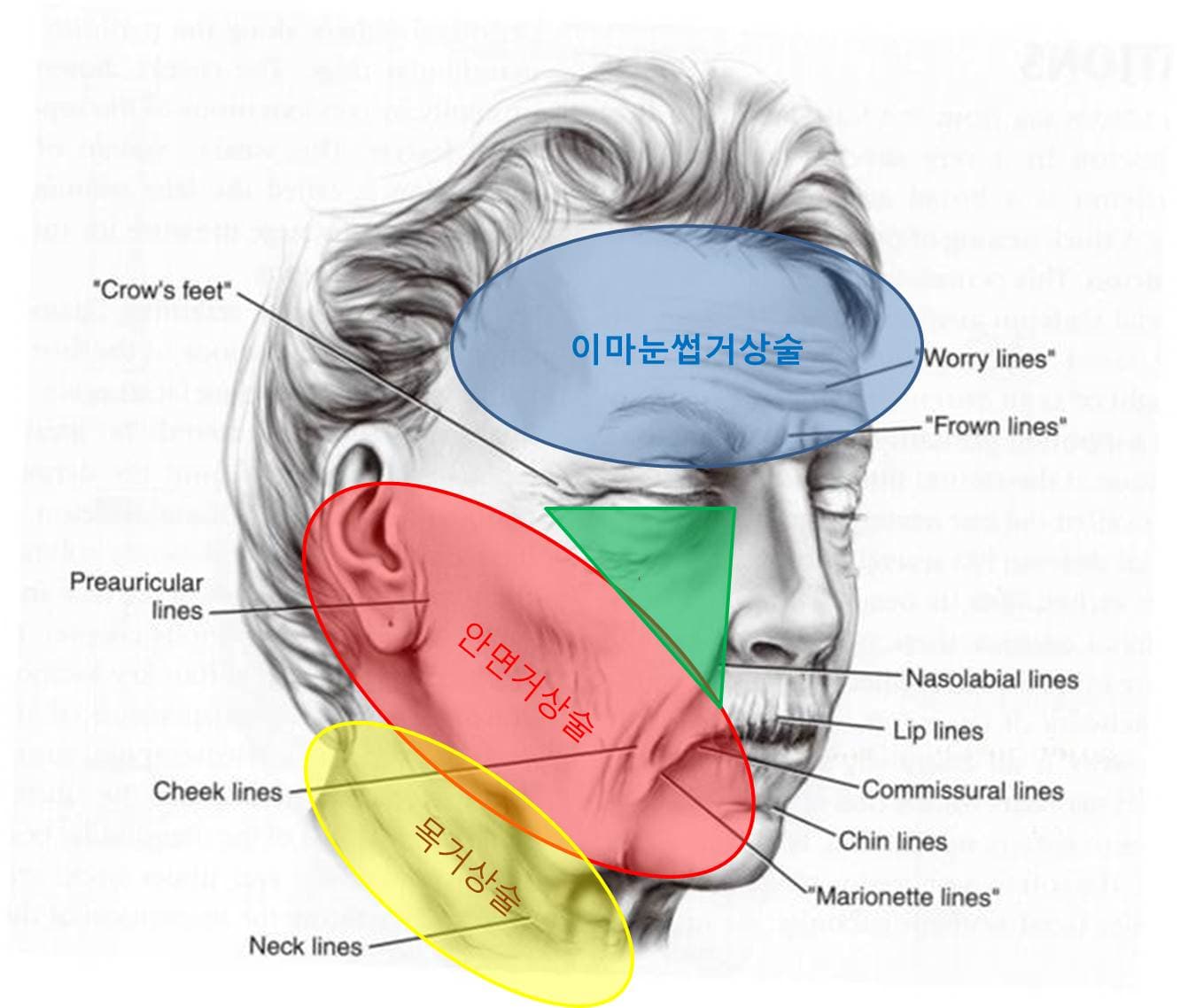거상수술별 개선 가능 부위 안내 이미지