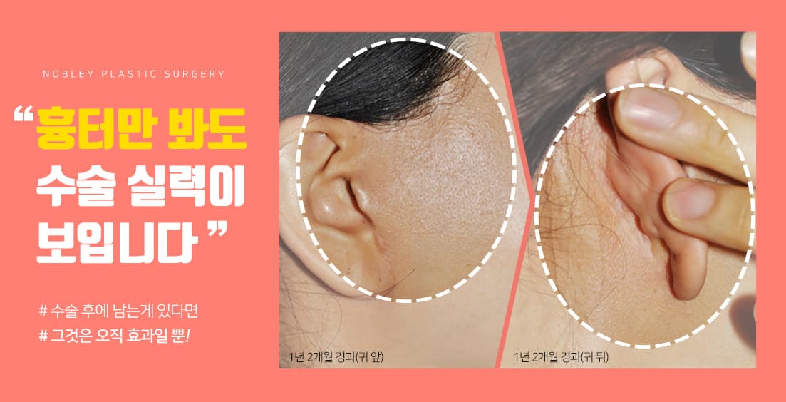 노블와이 성형외과 메인 슬라이드 3
