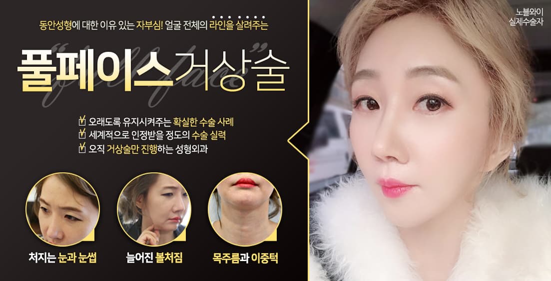 노블와이 성형외과 메인 슬라이드 8